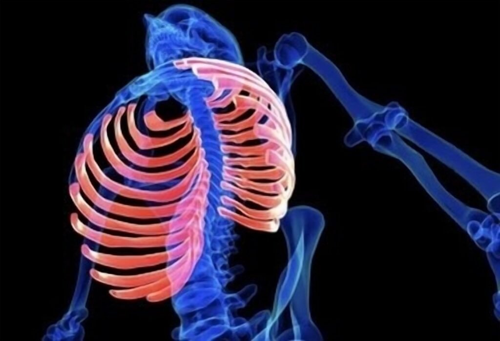 Full Rib Cage Protocol (incl. EZ Rib Fix)